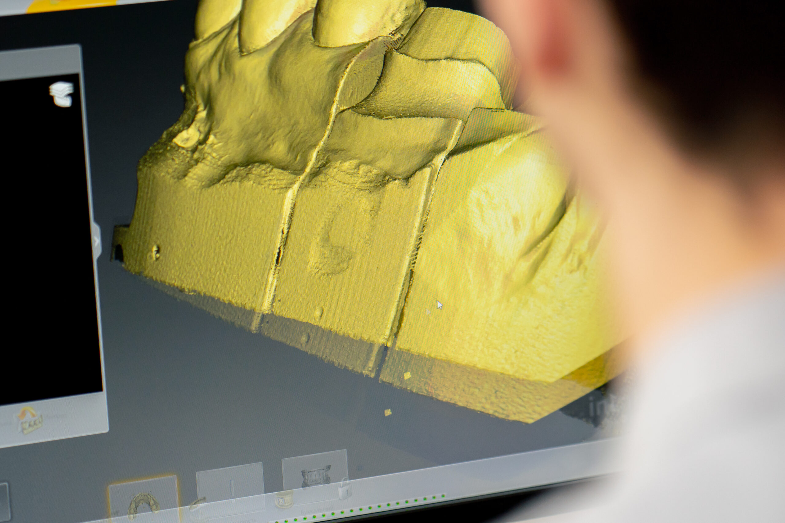 close up professional laboratory for production of dental protozoa veneers and crowns in a scanning machine dental impression to create a 3D model 360 degree rotation professional supervision