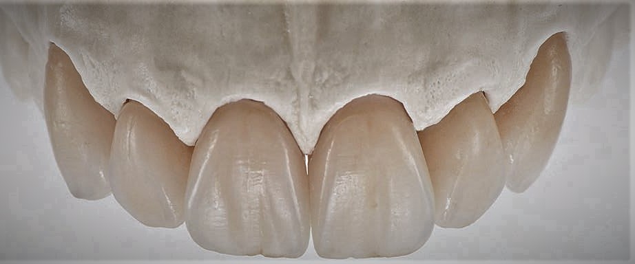 2017-02-16-18.11.52-1