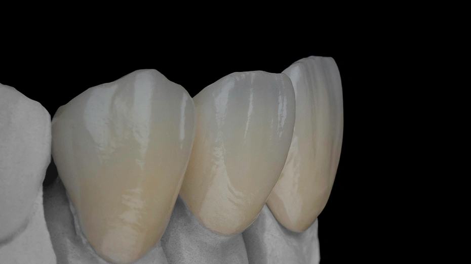 iph706.IPSE.MAXCAD04