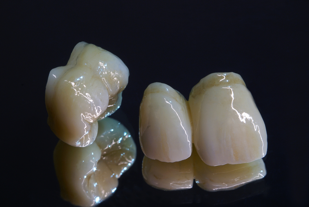 original_shutterstock_610380743