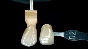 Full-Strength Monolithic Zirconia Crowns